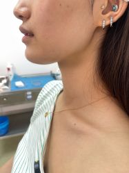 -长沙雅美医疗美容医院
