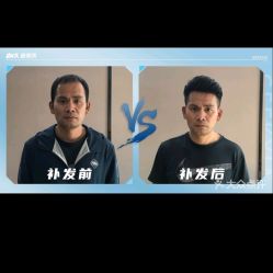 -极客侠男士假发定制补发