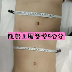 点击看大图 -Lily纤美·科技减脂中心