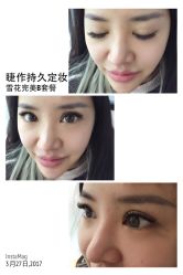 睫毛嫁接-光SPA科技美肤