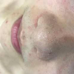 -新蝶变皮肤管理中心