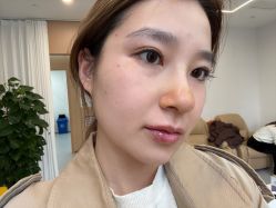 体验后-上海伊莱美医疗美容医院