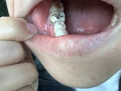 -上海市徐汇区口腔医院