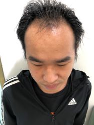 -发饰美男士增发补发假发定制店