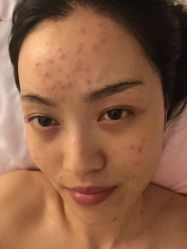 -皇族养心堂·净痘·修敏·御颜