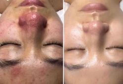 -美愈美肤MEIYU SKIN