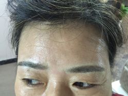 点击看大图 -郡艺医疗美容·微整·眼鼻吸脂