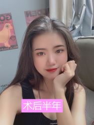 -广州健丽·去眼袋医疗美容机构