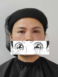 -天津健丽·去眼袋医疗美容机构