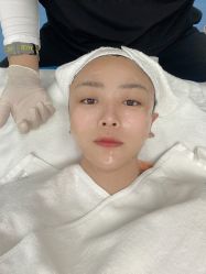 体验前-叶美人医疗美容