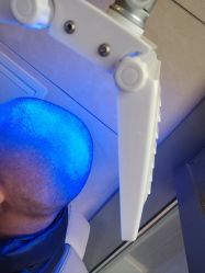 -碧莲盛·不剃发植发