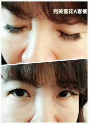 睫毛嫁接-光SPA科技美肤