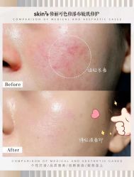 -skin79皮肤管理中心