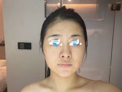 -新美荟医美·专注面部美学抗衰