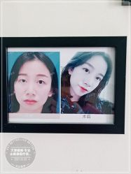 -天津健丽·去眼袋医疗美容机构