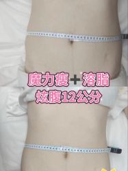 -Lily纤美·科技减脂中心