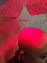 -碧莲盛·不剃发植发