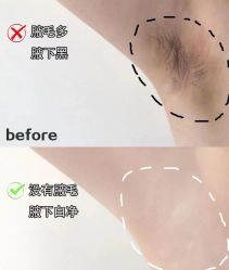-HEYAN荷妍专业脱毛连锁机构