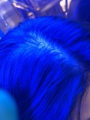 体验后-碧莲盛·不剃发植发