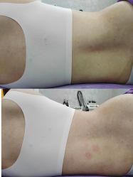 -美丽妈妈产后恢复中心(南桥旗舰店)