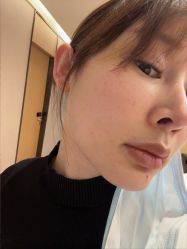 -Yestar杭州艺星医疗美容医院
