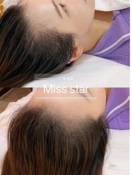 -MISS STAR·半永久纹眉·发际线·美瞳线