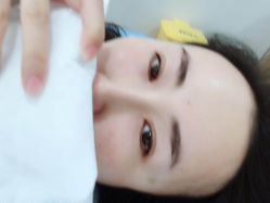 点击看大图 体验后-北京炫美医疗美容