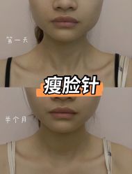 -上海漾颜医疗美容