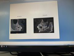 -北京大学口腔医院(第二门诊部)