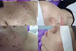 -痘敏医生专业祛痘·肌肤修复连锁