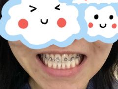 -极光口腔·矫正种植修复(锦江店)