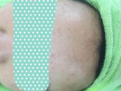 -苗医生草本科技祛痘