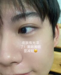 体验后-北京楚诺医疗美容