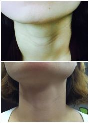 -苑苑vbeauty科技美容SPA