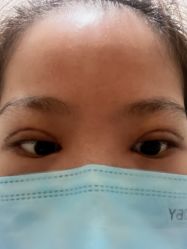 体验后-西安伊美尔医疗美容医院