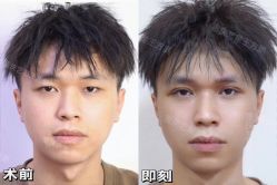 -Yestar重庆艺星医疗美容医院