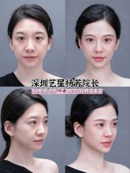 -深圳艺星医疗美容医院
