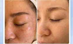 -美肤盾祛痘·问题肌头疗管理中心