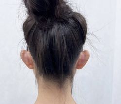 -杭州米兰柏羽医疗美容医院