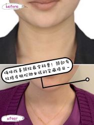 -新美荟医美·专注面部美学抗衰