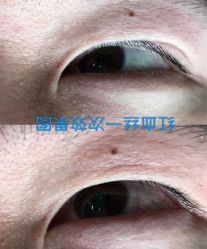 -晶奕空间专业脱毛连锁机构