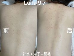-LUNA皮相美·骨相美高级美感