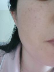 -空军总医院激光整形美容中心