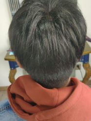 点击看大图 -极客侠男士假发定制补发