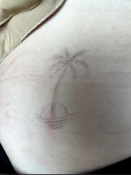 -杭州米兰柏羽医疗美容医院