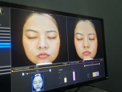 体验后-杭州医巢医疗美容