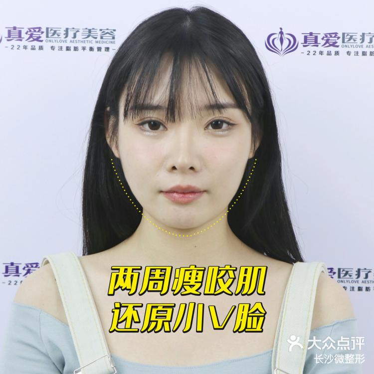 微整形注射美容笔记（美容院笔记怎么写吸引人） 微整形注射美容条记
（美容院条记
怎么写吸引人）《微整形注射美容书》 整形美容