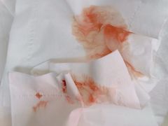 -上海仁爱医院口腔科 · 种植