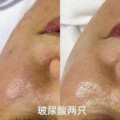 -LUNA皮相美·骨相美高级美感
