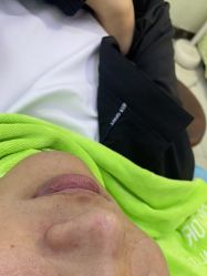 -苗医生0感祛痘连锁